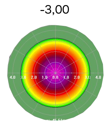 meilleur chirurgien lasik paris