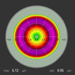 lasik presbytie presbylasik