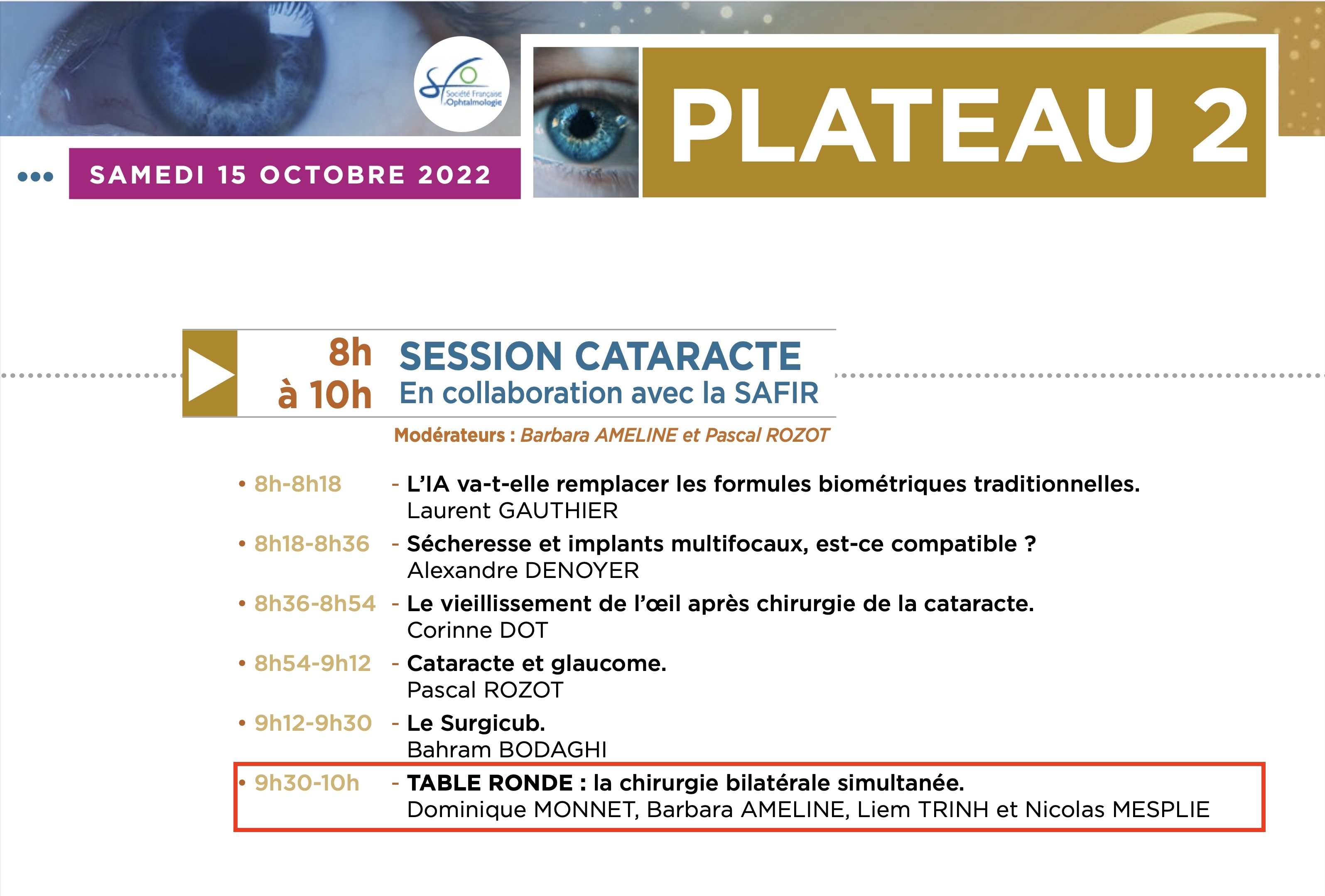 Session cataracte SFO Paris