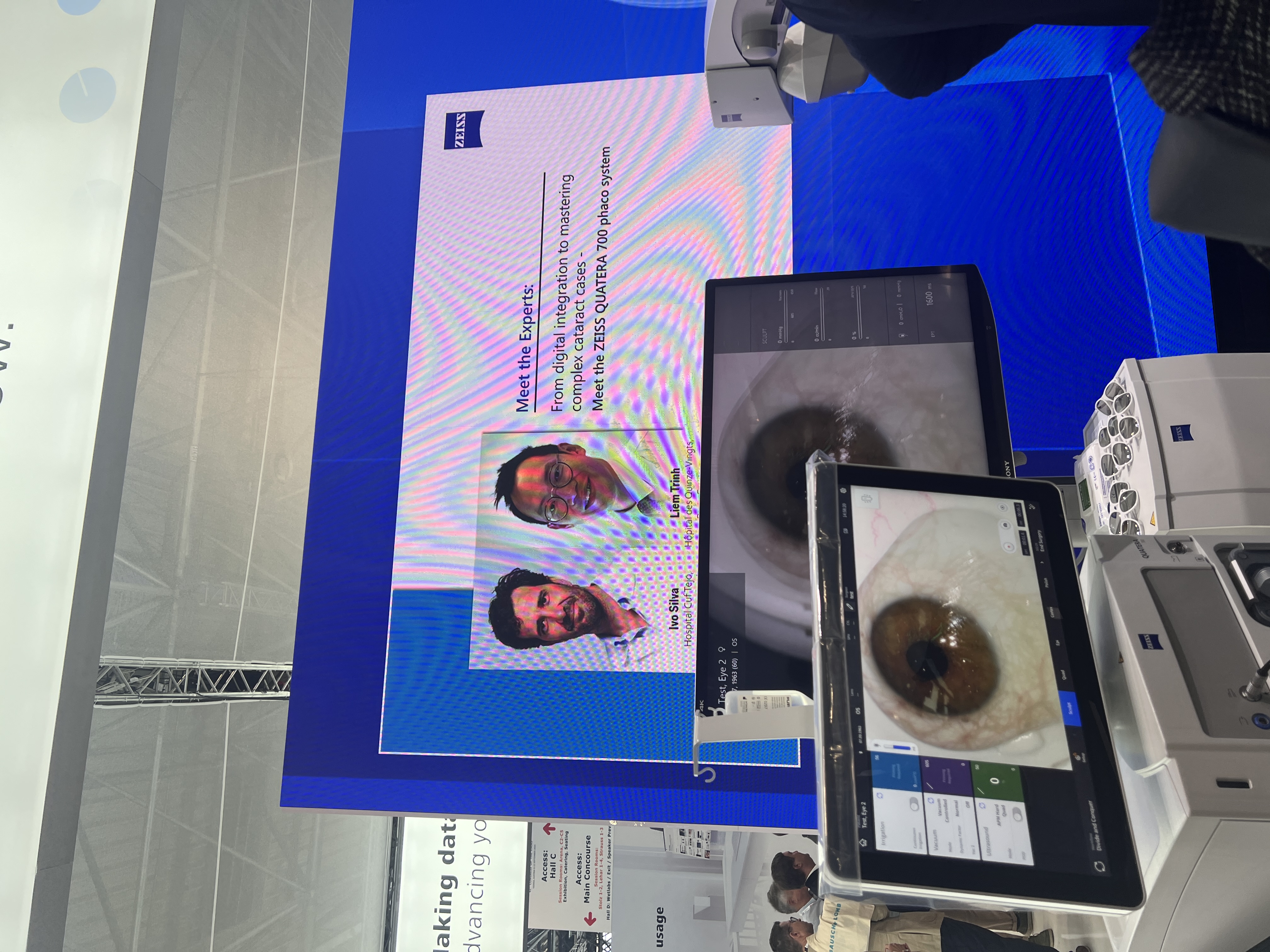 phaco émulsification paris