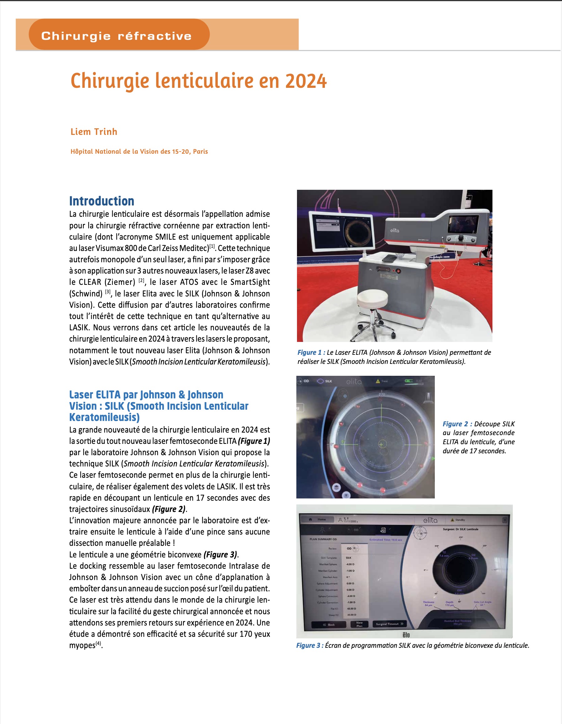 chirurgie réfractive SMILE