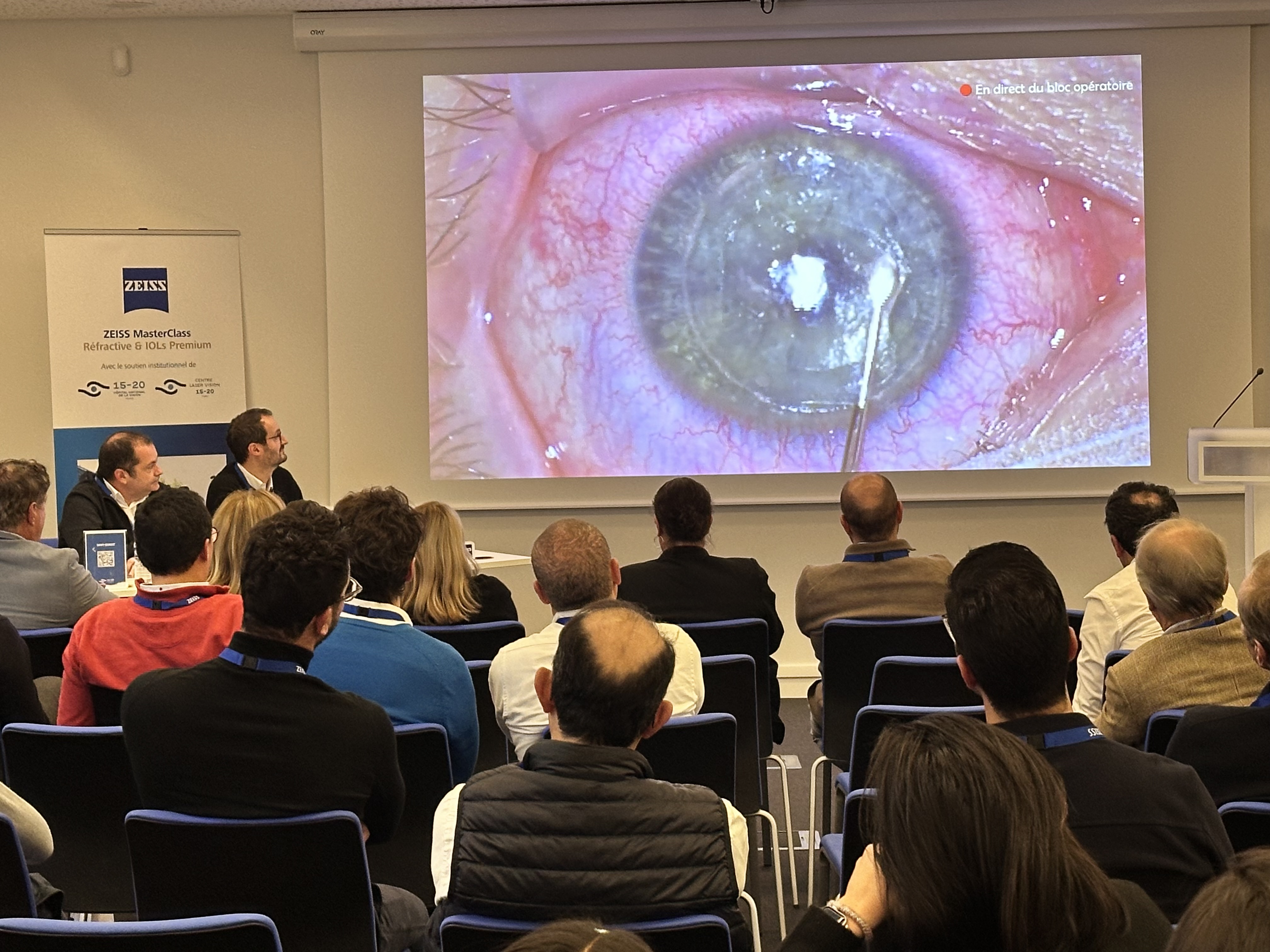 SMILE hypermétropique Paris