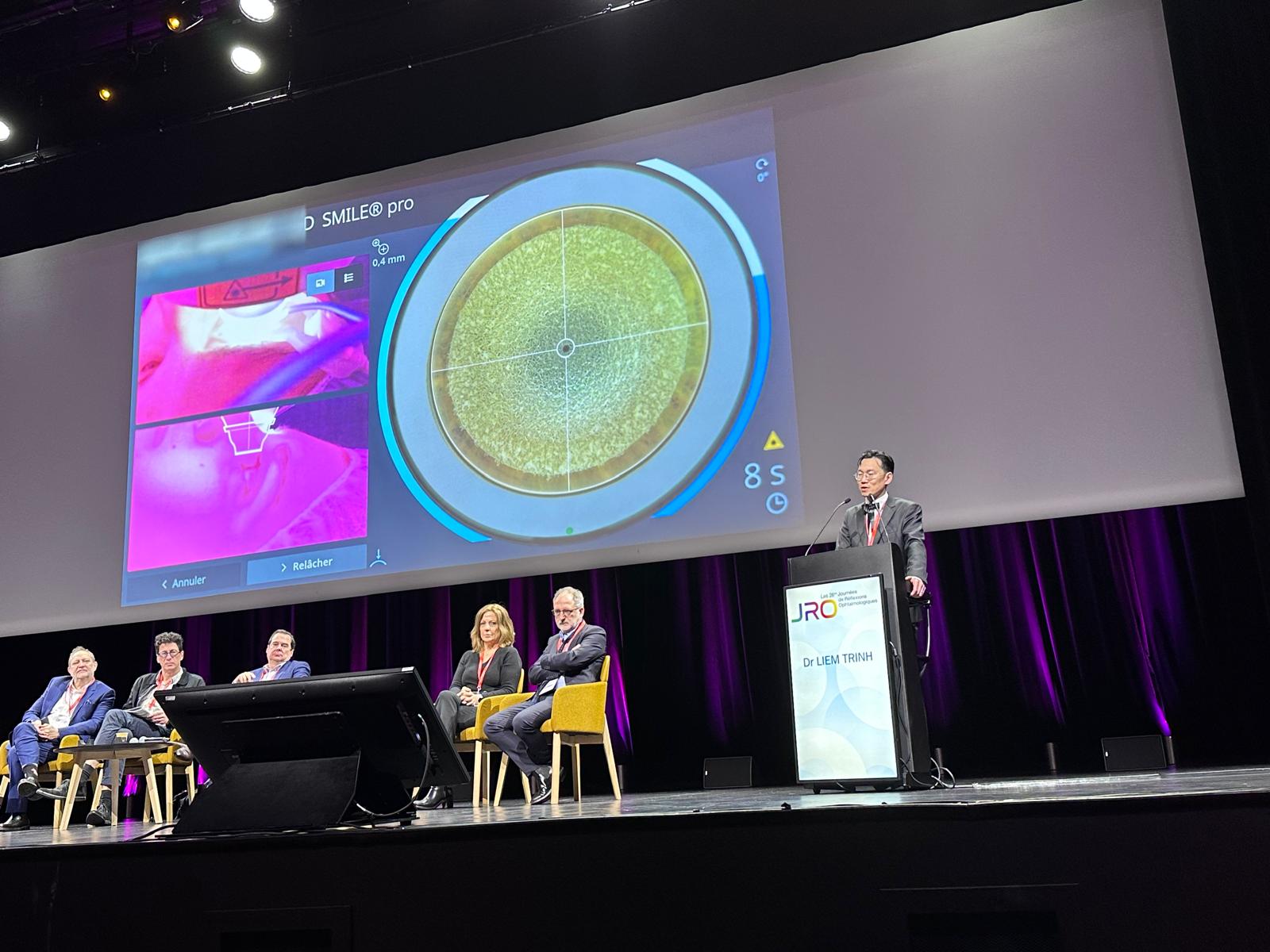 SMILE lenticule réfractive Paris