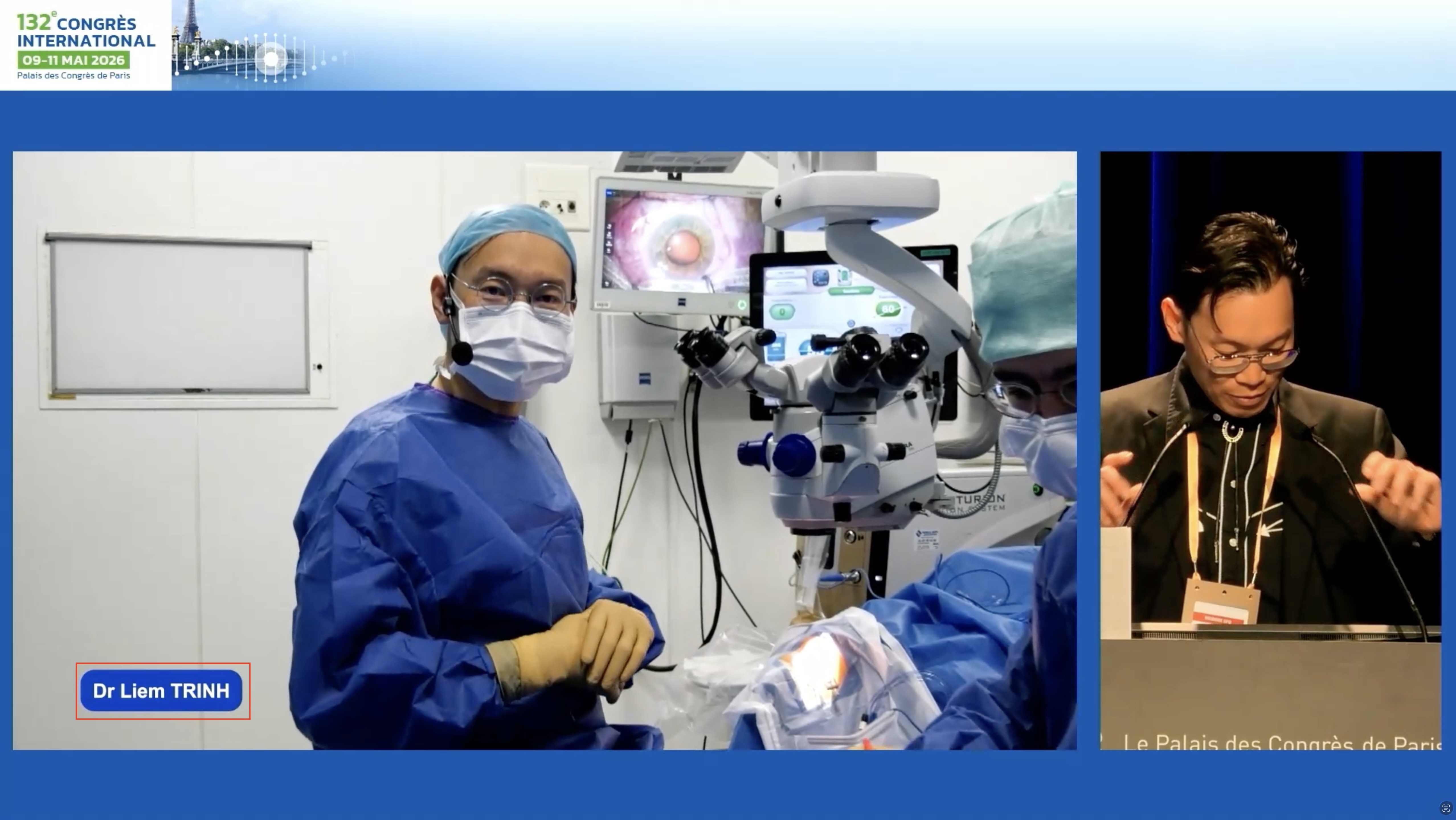 chirurgie de la SFO cataracte